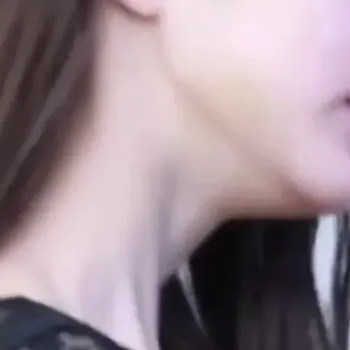 턱 왜 이러는거에요?