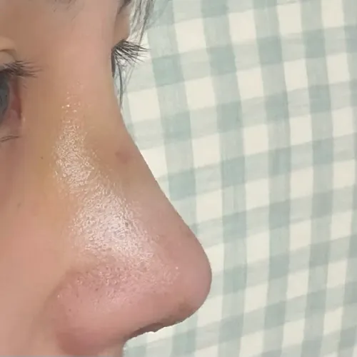 코일주일됏어요