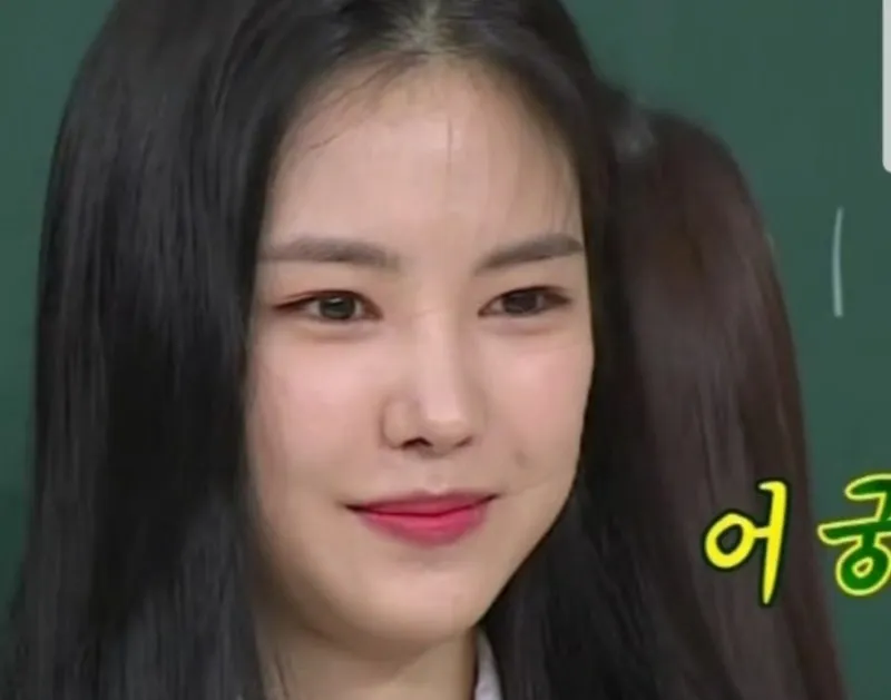 손나은은 앞트임 왜한걸까5