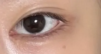 눈