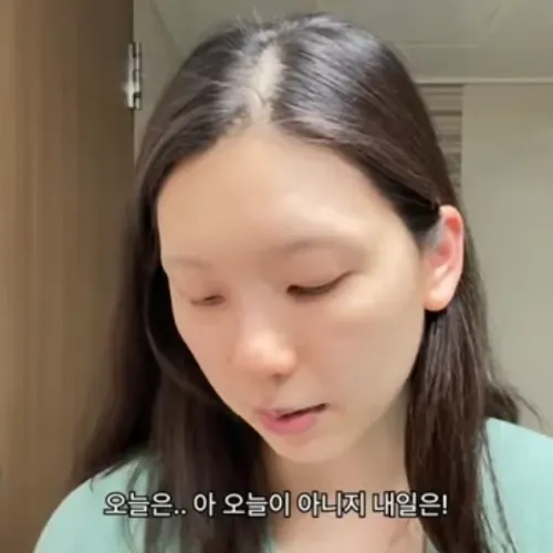출산 탈모 ㅠ