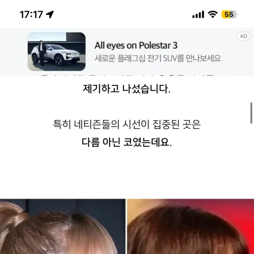 저 코수술 계획 잡았는데
