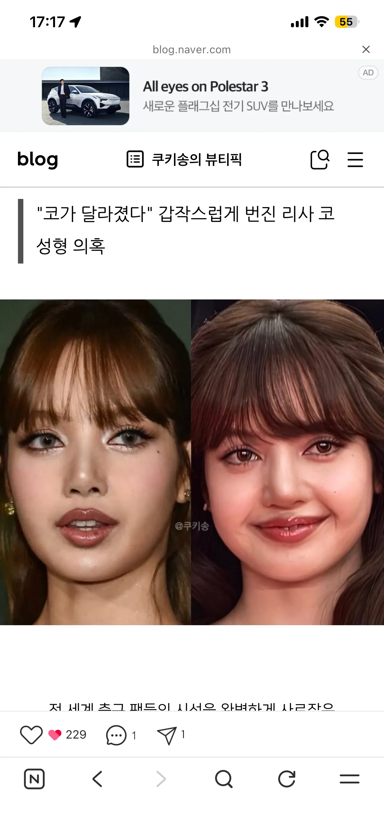 저 코수술 계획 잡았는데2