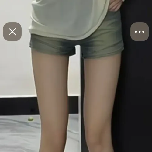 일자종아리