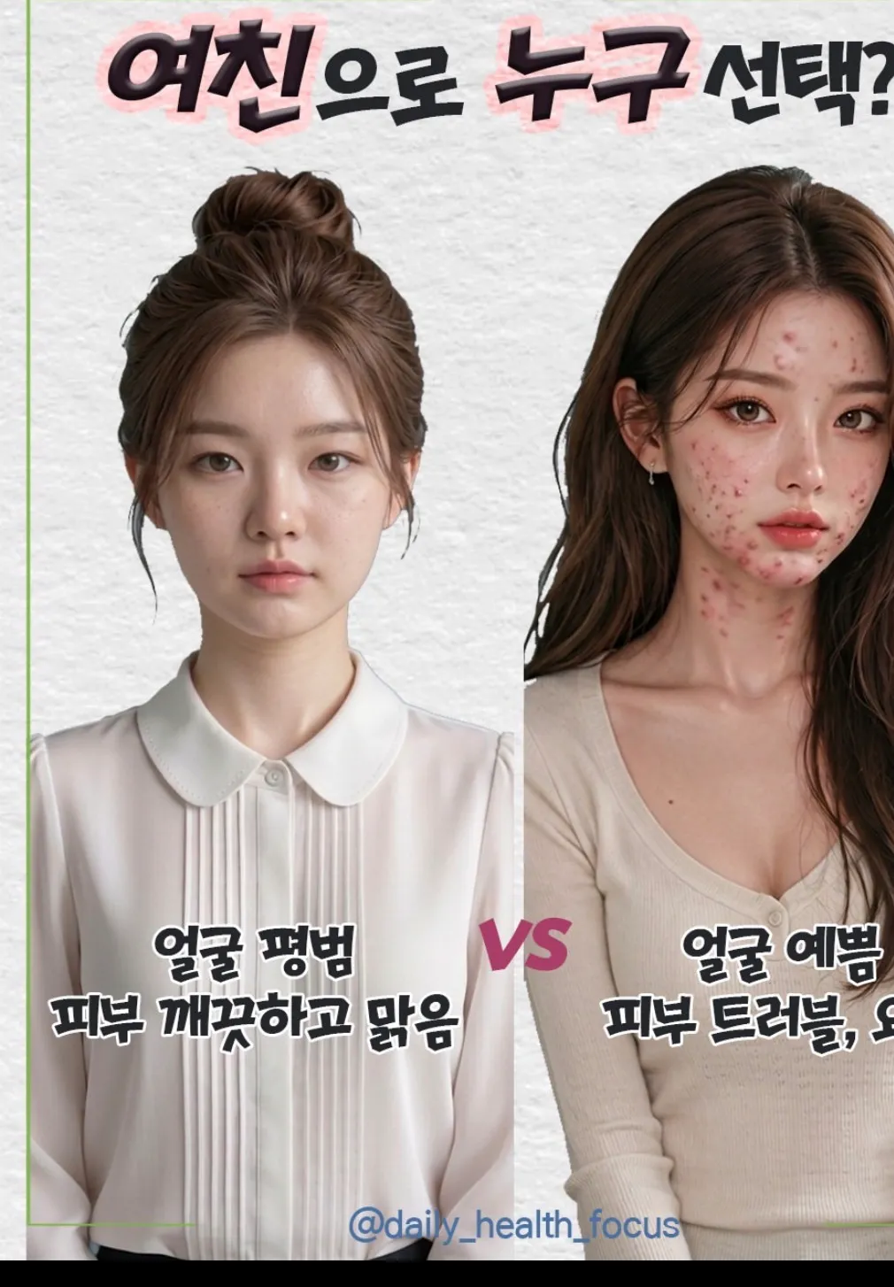 초이스는