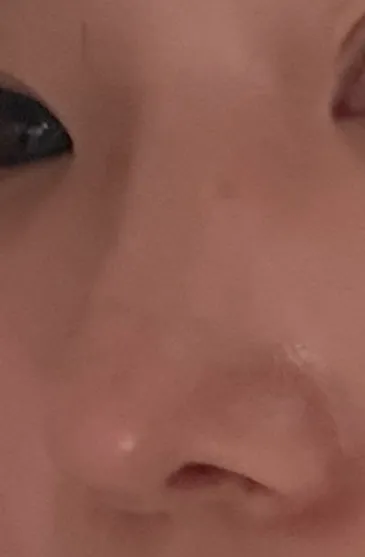 코 한지 1년지났는데2