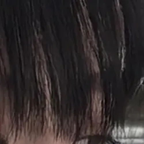 코에 살붙은건지 변형된건지 봐주세여