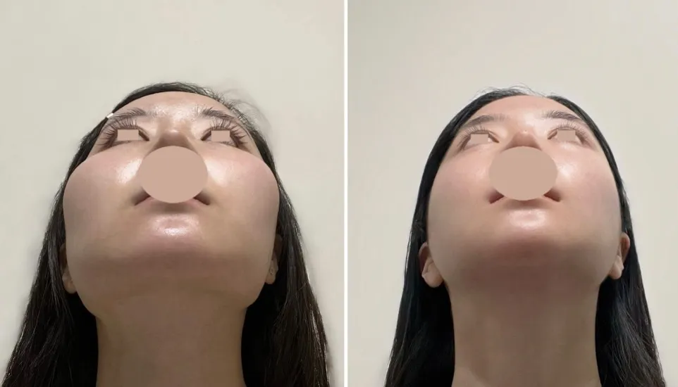 와 윤곽 전후 지리네