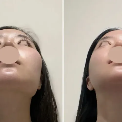 와 윤곽 전후 지리네