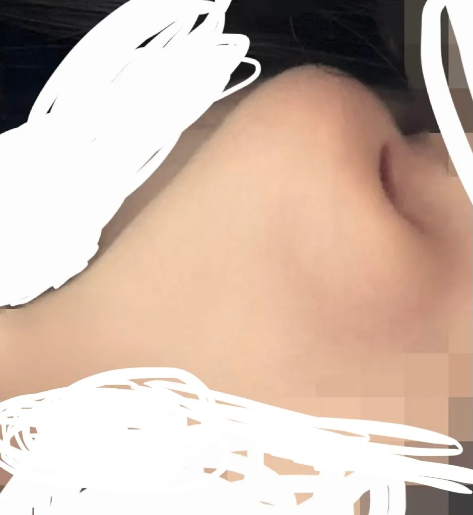 코 할? 말..?ㅠㅠ