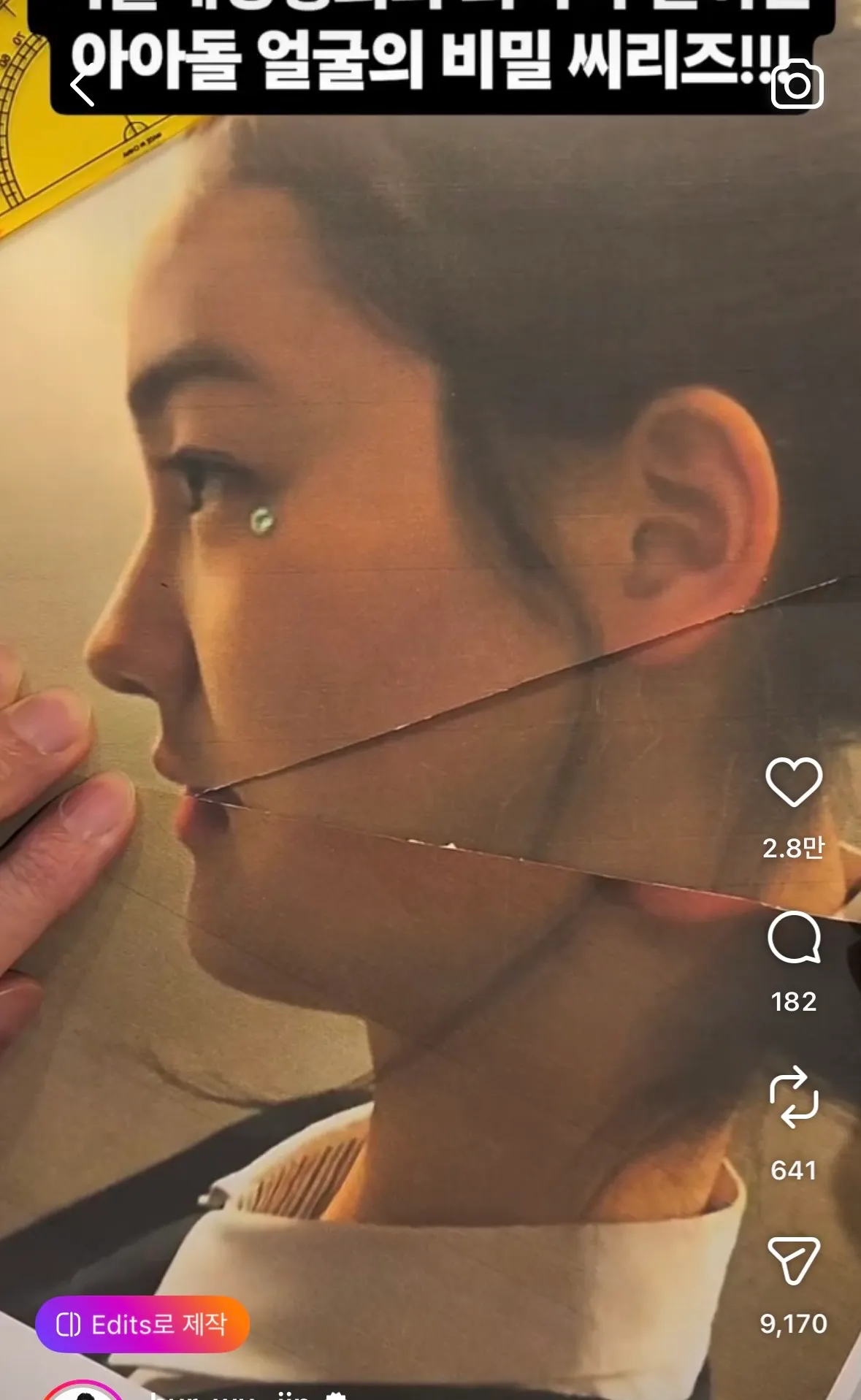 ㅇㅇㄹㅁ 릴스인데 양악