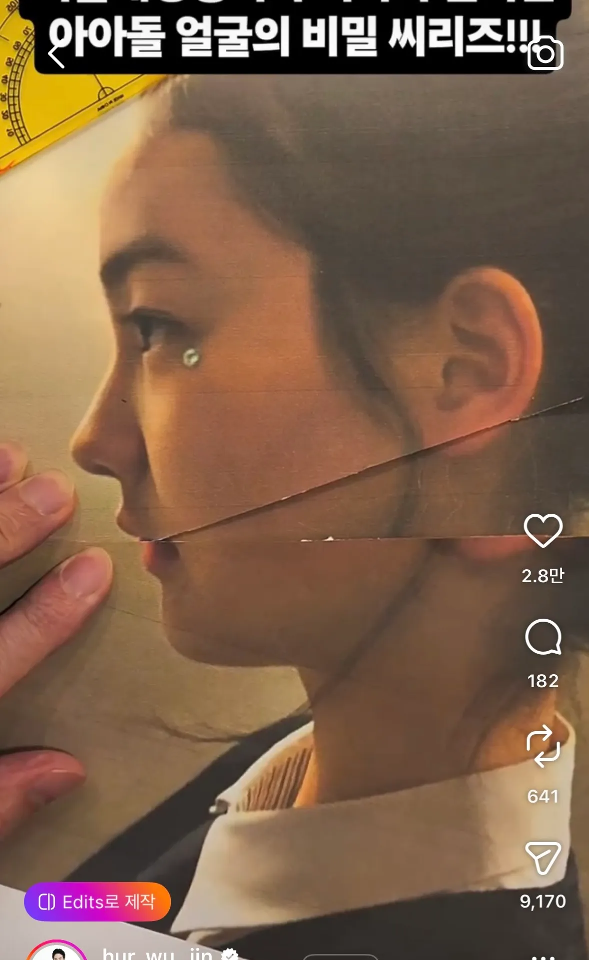 ㅇㅇㄹㅁ 릴스인데 양악2