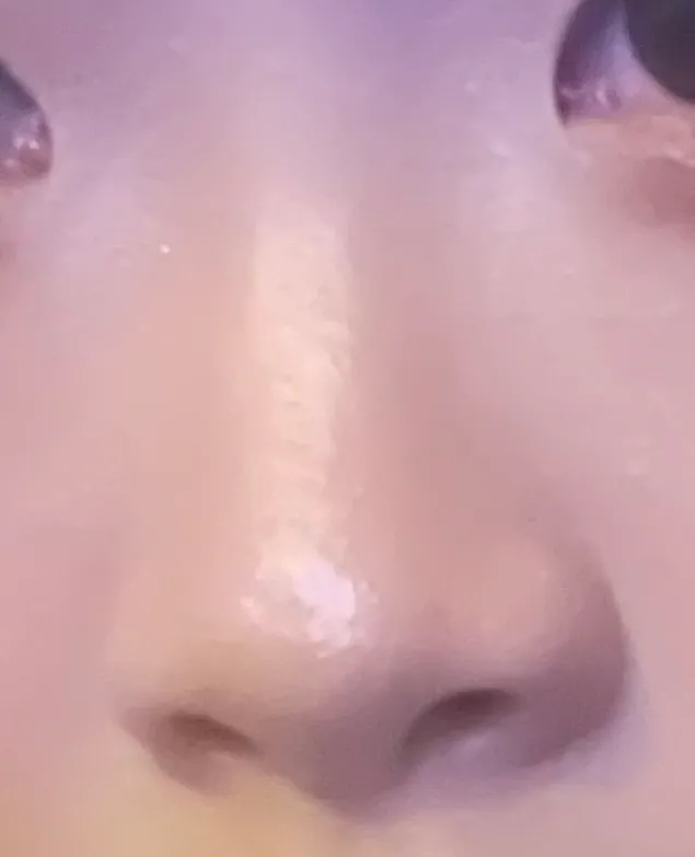 코 부작용 오는게 너무 무서워서2