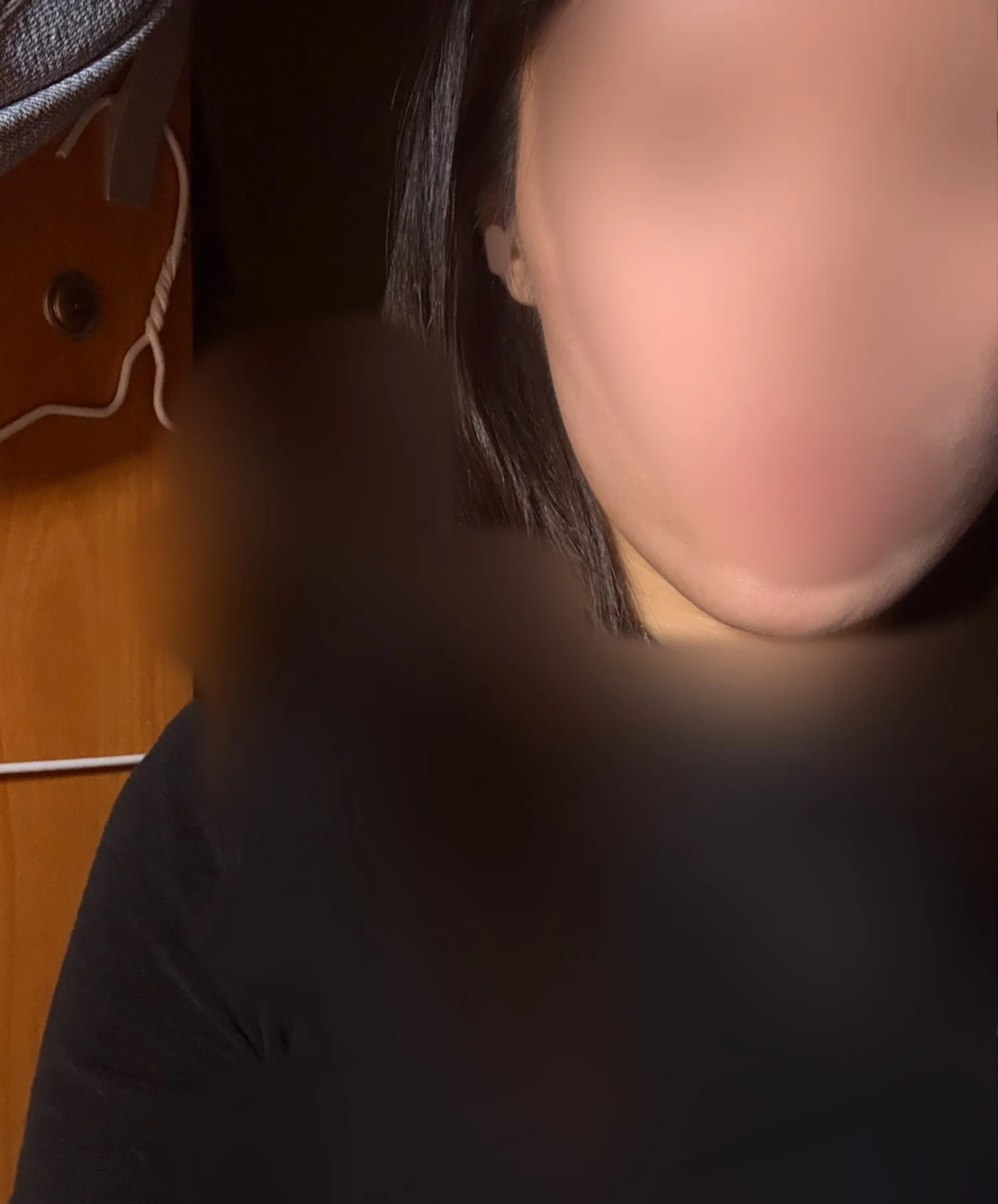 옆볼필러 맞아야겟져?