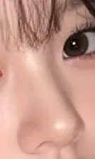이런 코 잘하는 병원 아는언니...?