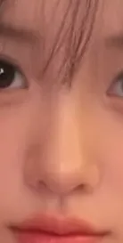 이런 코 잘하는 병원 아는언니...?3