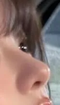 이런 코 잘하는 병원 아는언니...?2