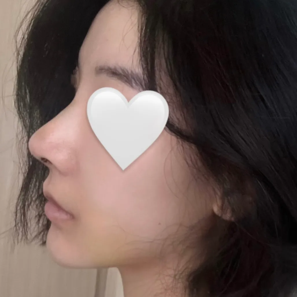 부목