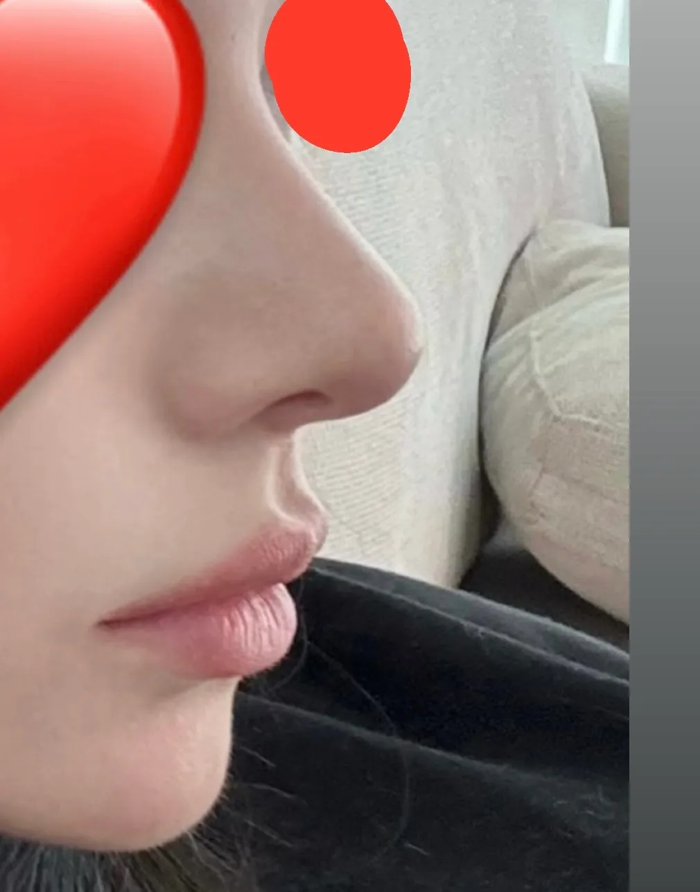 코 너무 티나나요ㅠㅠ