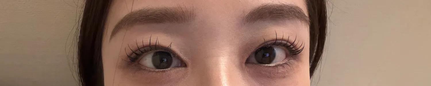 밑트임 할까여말까여