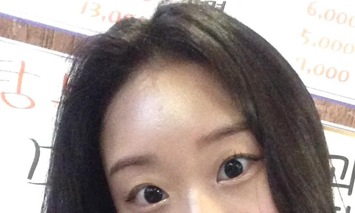 눈 라인 올리기+트임 어떨까요ㅠㅠ2