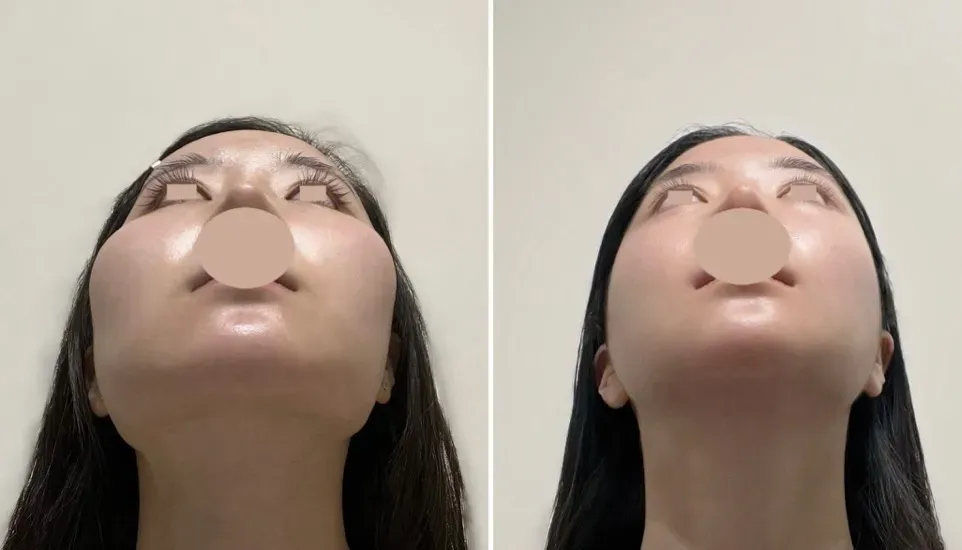 저 왼쪽급 윤곽인데