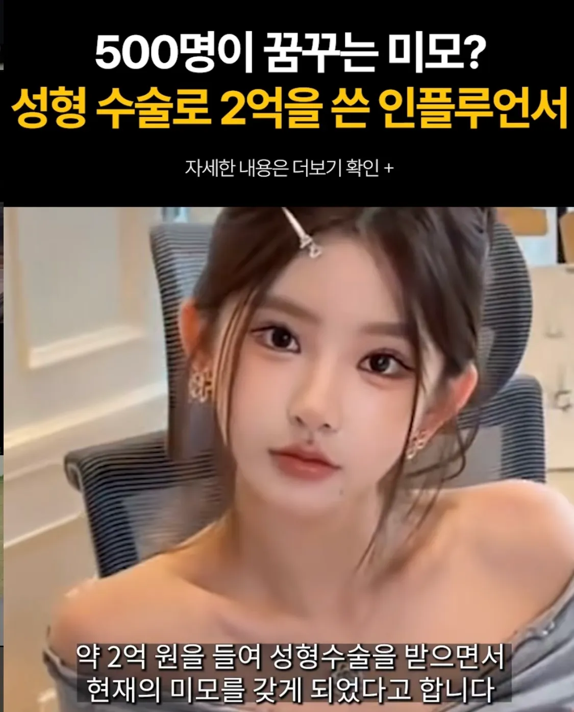 성형