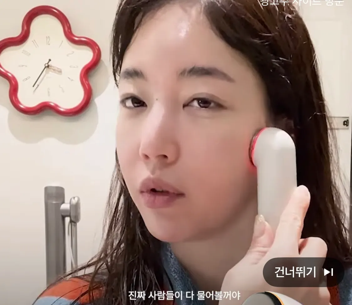 기은세 눈앞머리 앞트임흉이에요?3