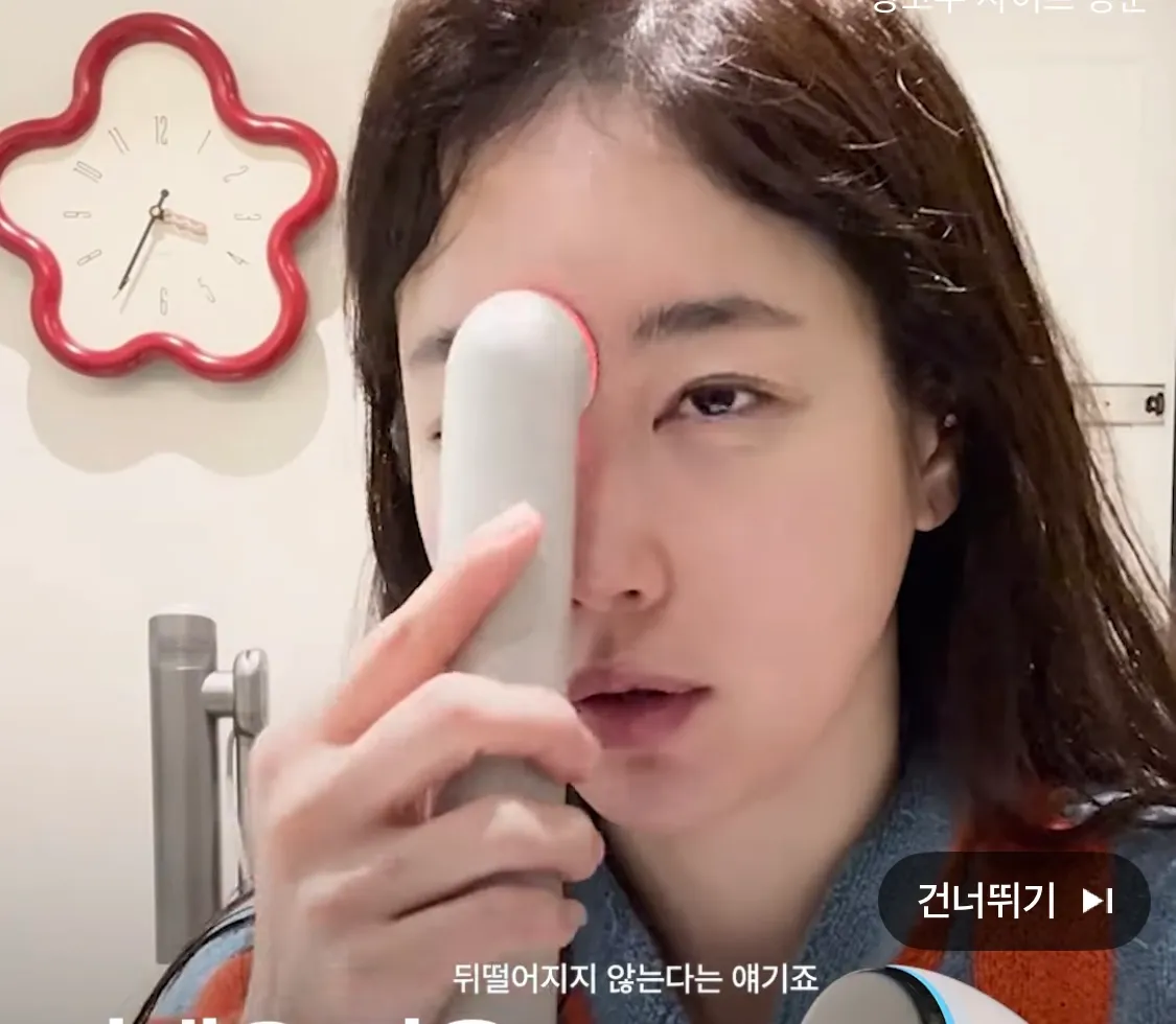 기은세 눈앞머리 앞트임흉이에요?4