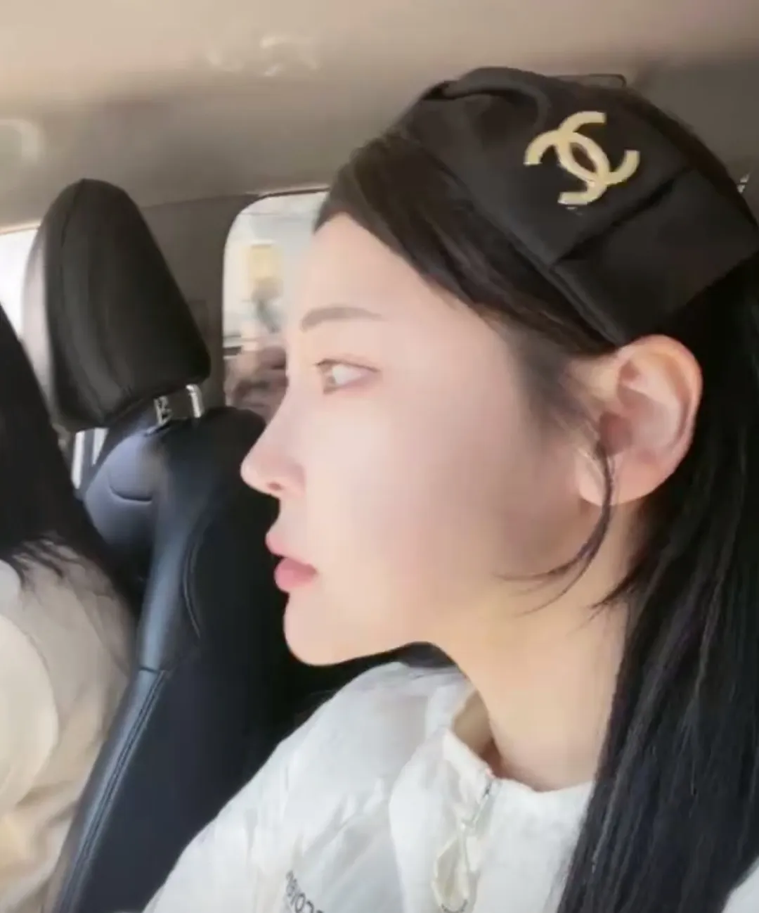 이런 턱이 앞턱 전진으로 만든걸까요