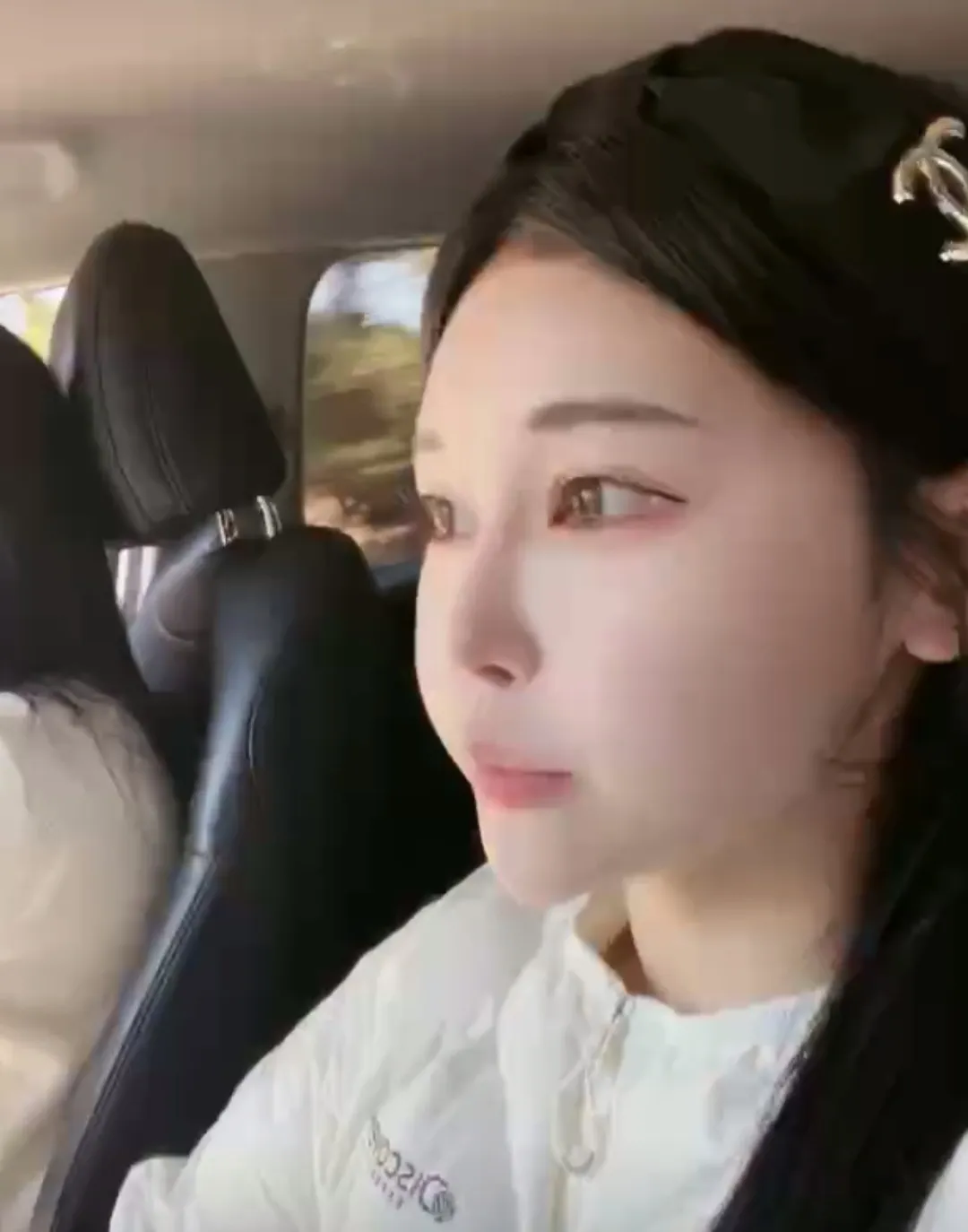 이런 턱이 앞턱 전진으로 만든걸까요2