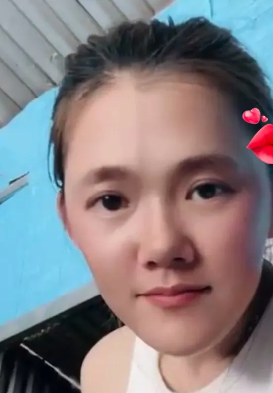 이런 턱이 앞턱 전진으로 만든걸까요6
