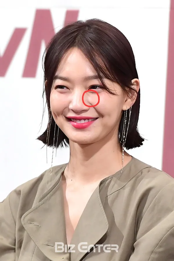 앞볼?눈밑?패이는거요ㅠ
