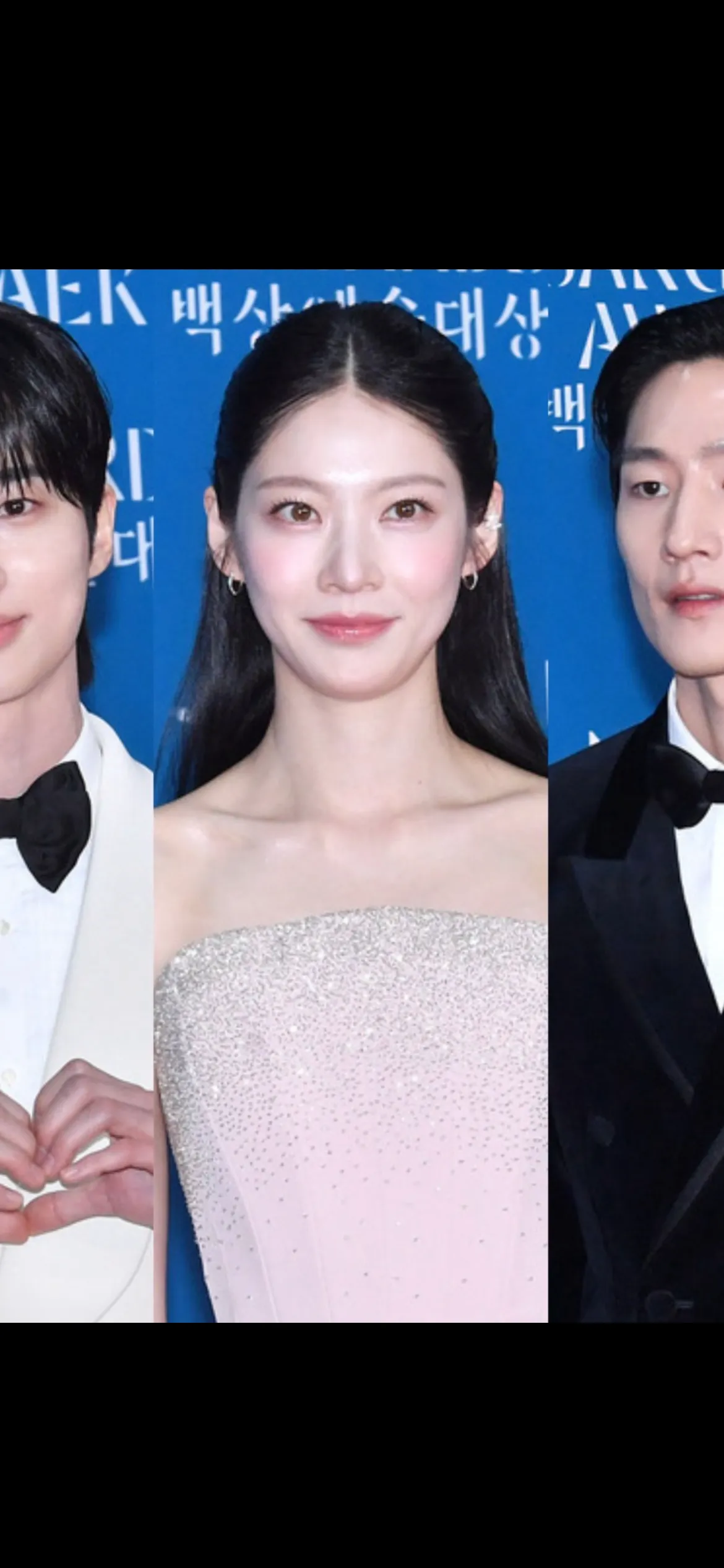 웃을 때 볼 근육