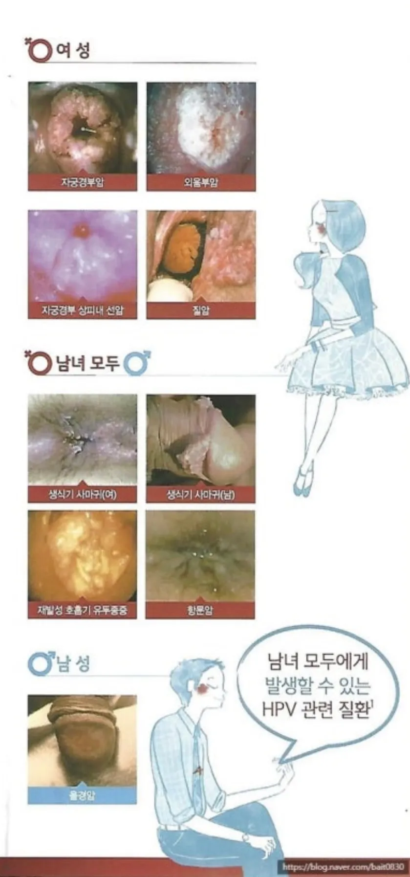 사진 혐주의