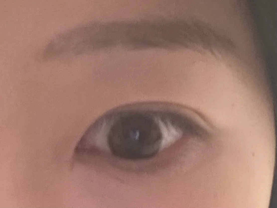 언니들 이런 눈 어떻게 고쳐야할까요2