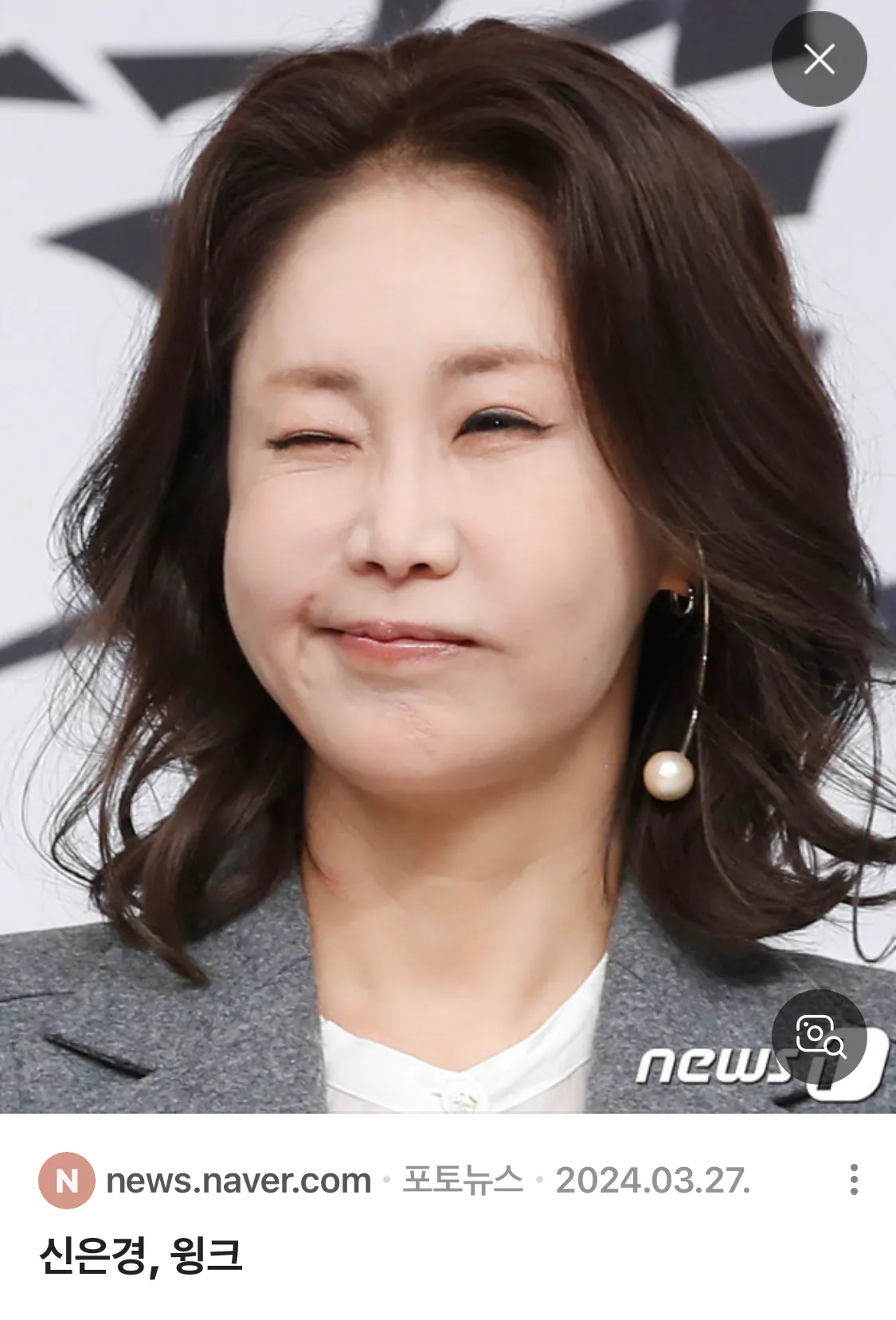양악하고싶은데 다 저렇게 되는건 아니죠?2