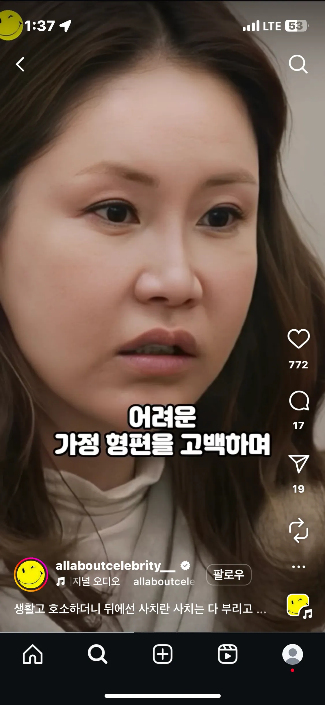 양악하고싶은데 다 저렇게 되는건 아니죠?4