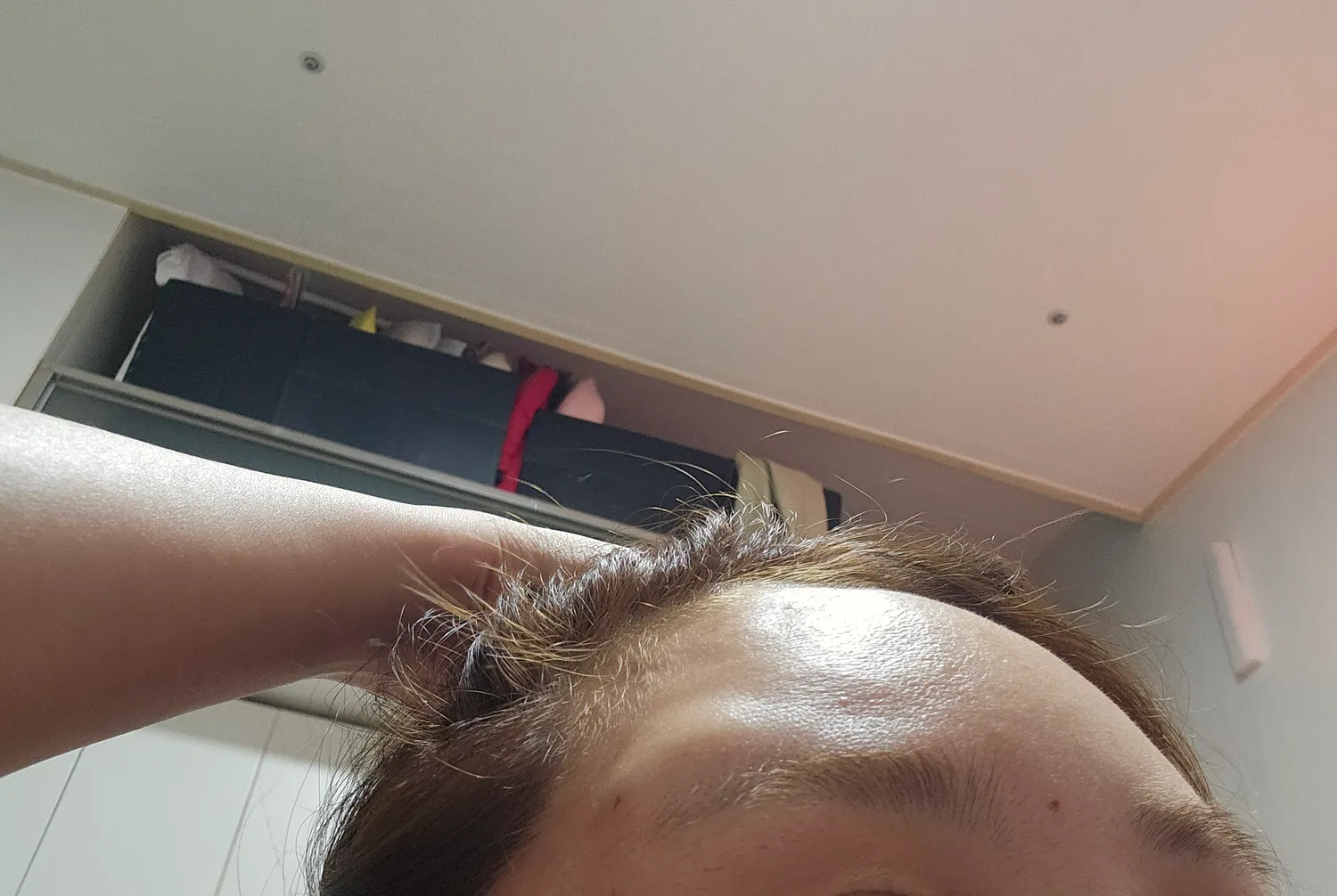 언니들 저이마필러 봐주세요