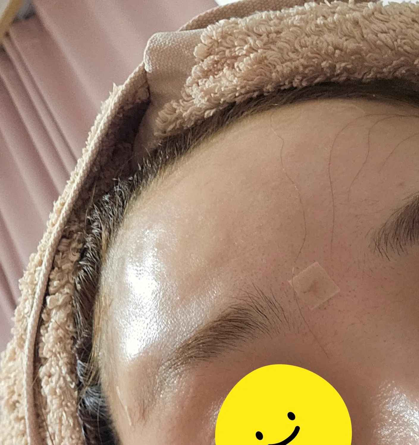 언니들 저이마필러 봐주세요2