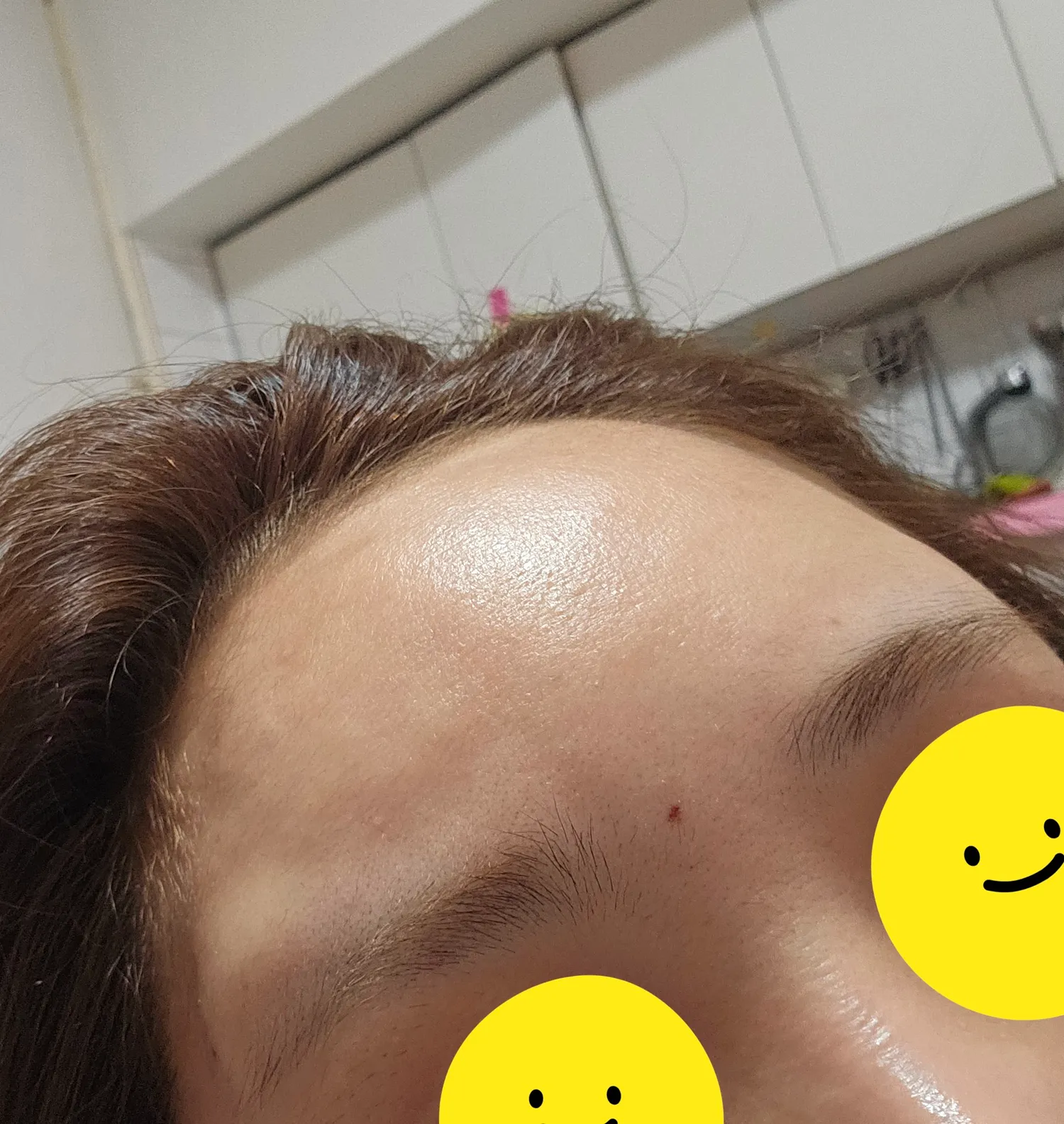 언니들 저이마필러 봐주세요3
