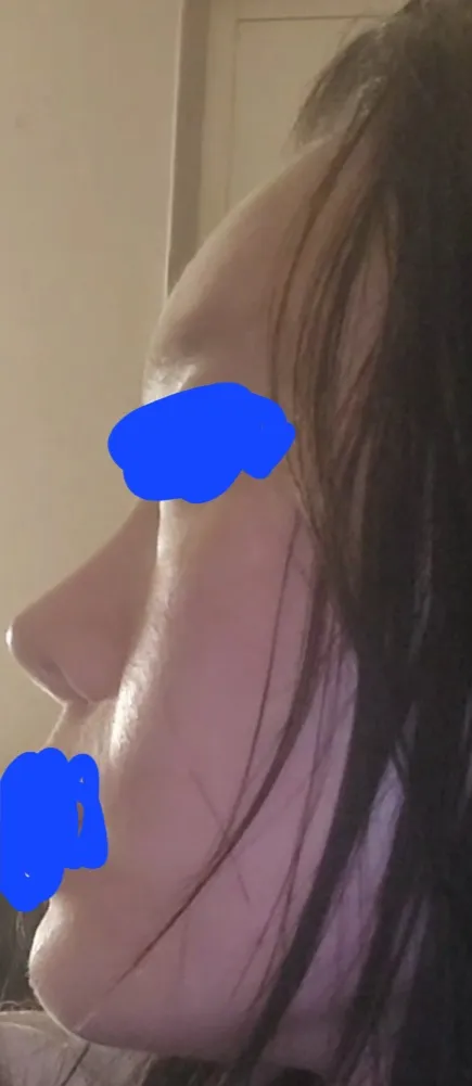 언니들 저처럼 앞광에 살 없는 사람있나여..