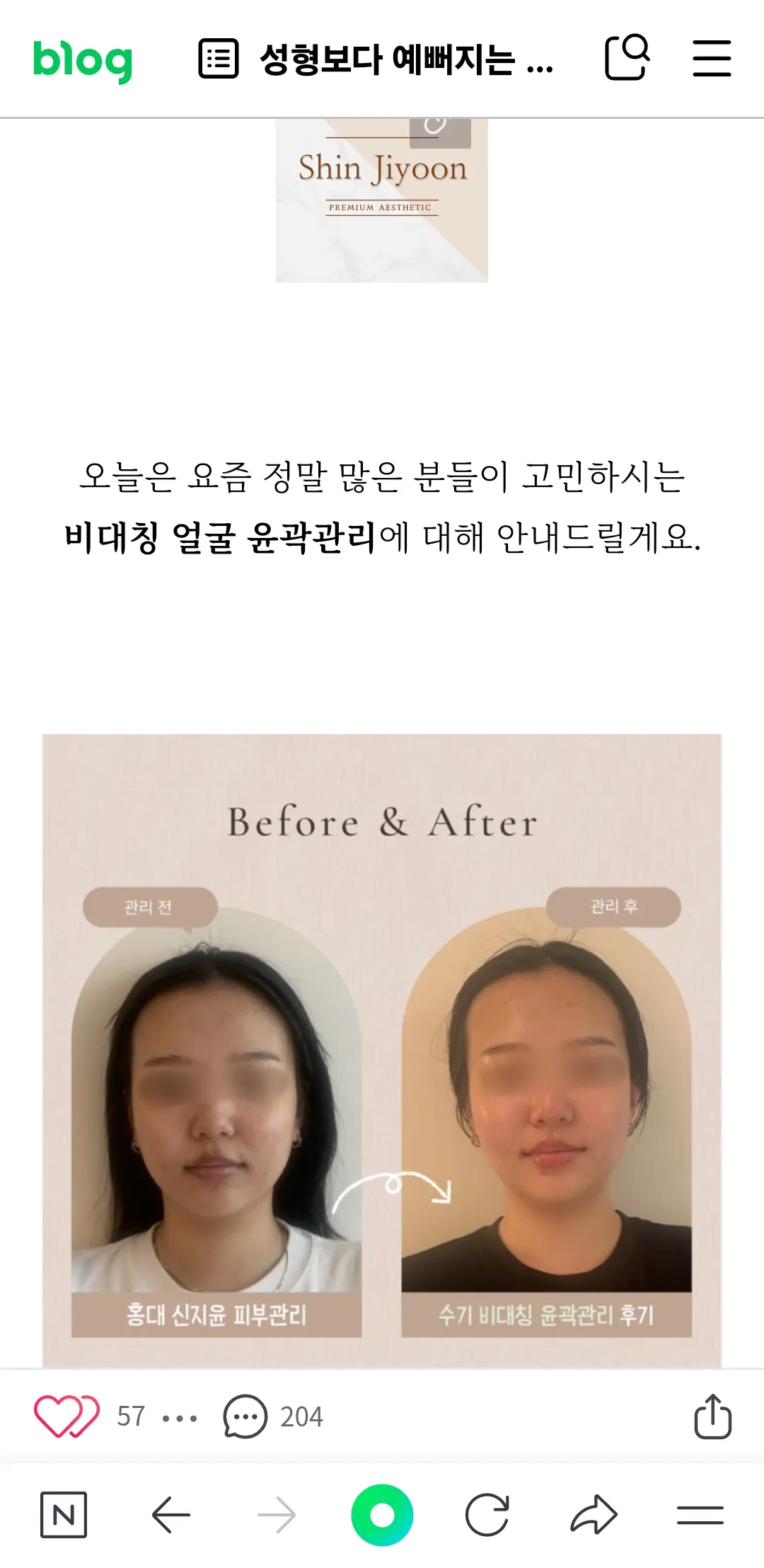 앞광대만 올라간거같죠?
