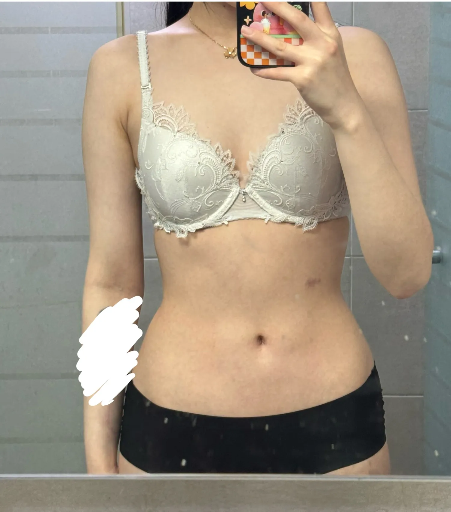 저 2시간 후에 상체지방흡입해요2