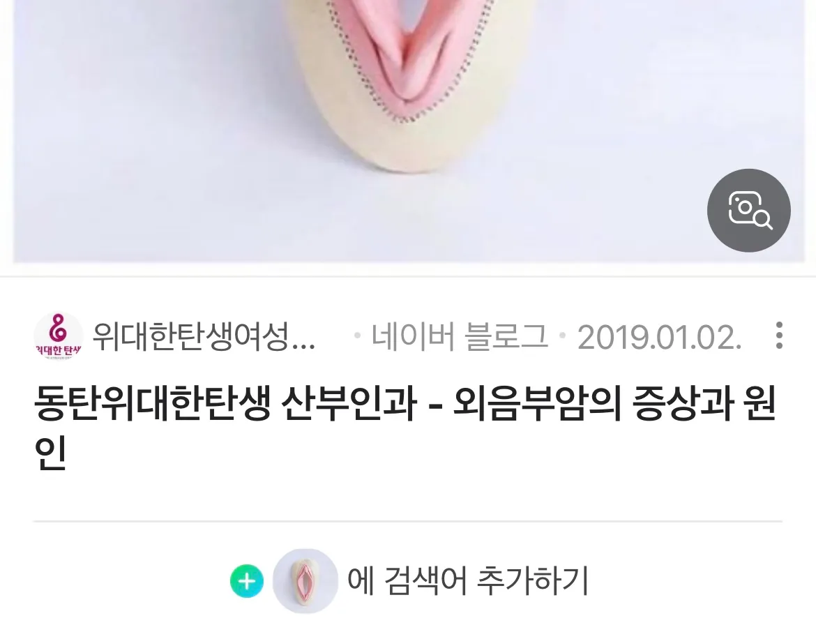저만 ㅅㅅ하고 나면 저부분이 아픈가요