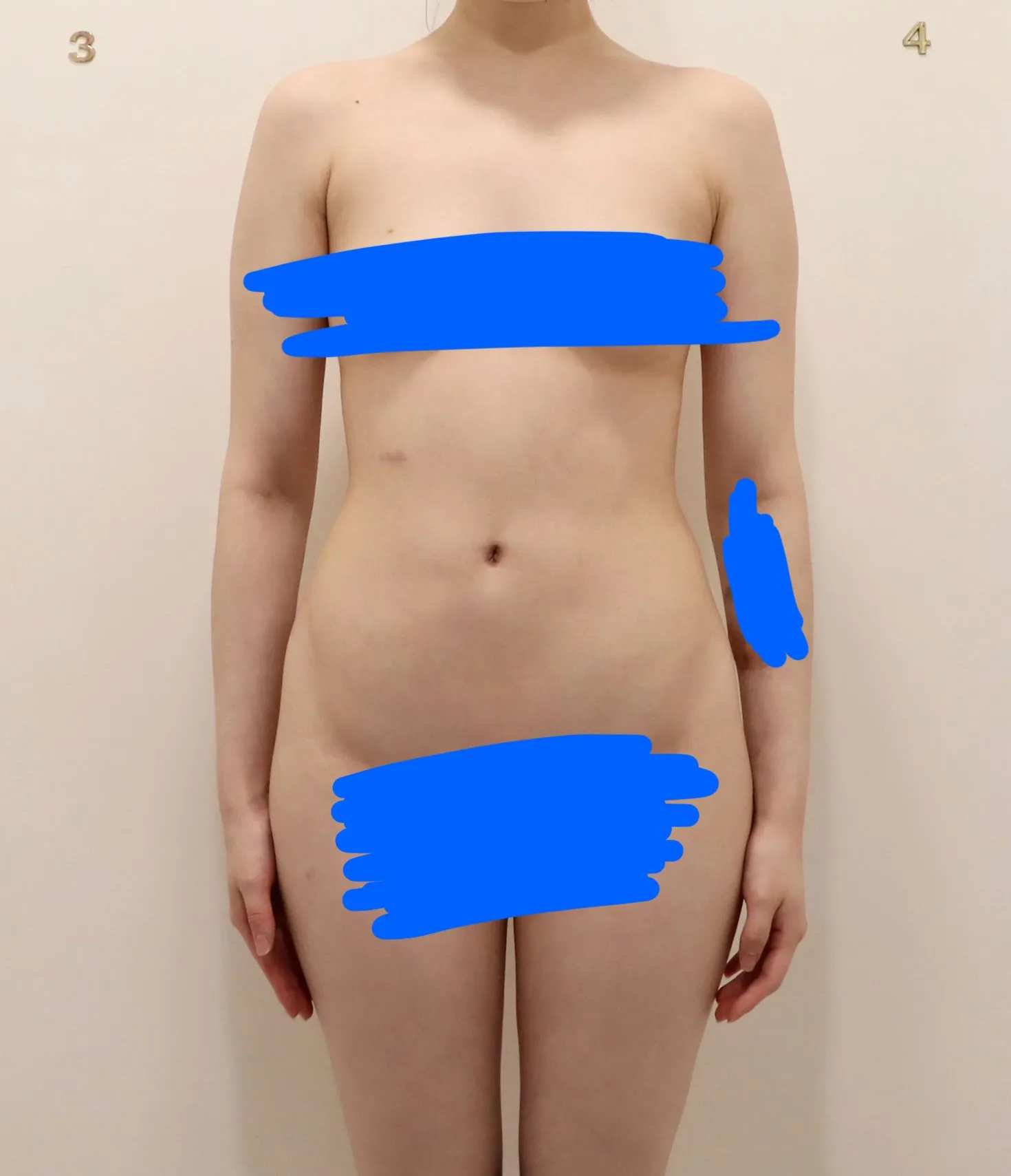 혐주의)이정도면 지흡 변화 큰거예요?2