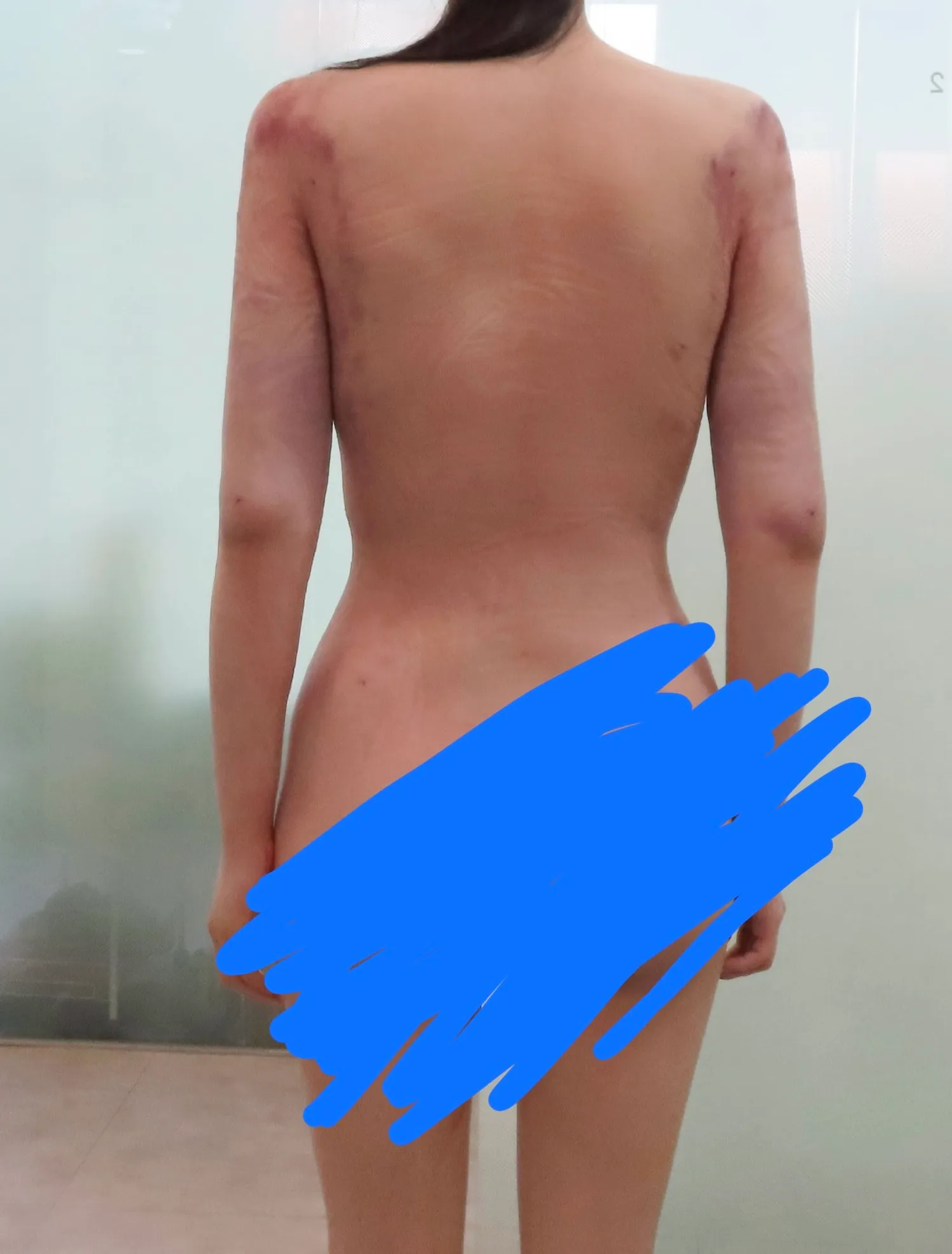 혐주의)이정도면 지흡 변화 큰거예요?4