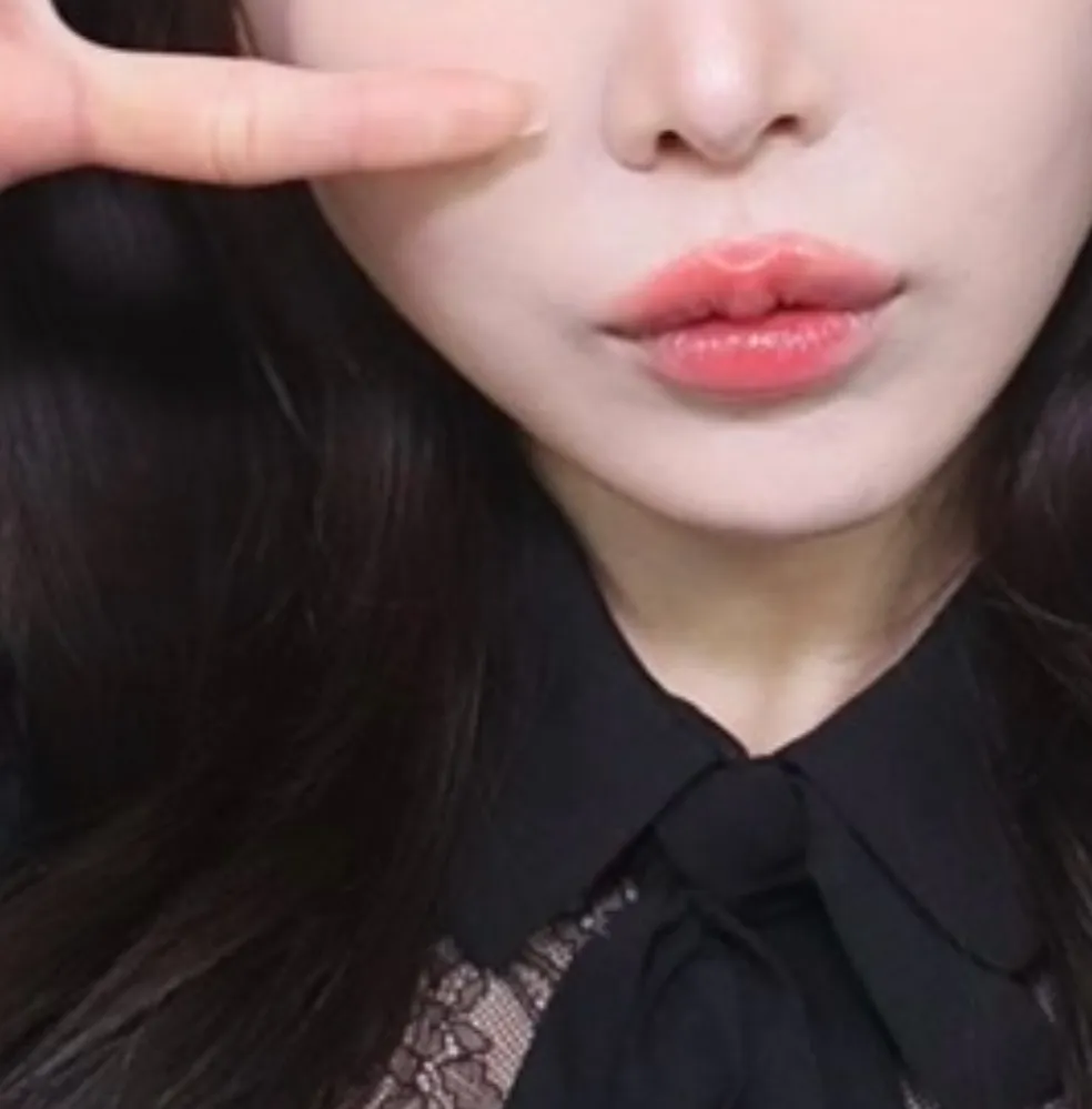 저 인중축소 했으요2