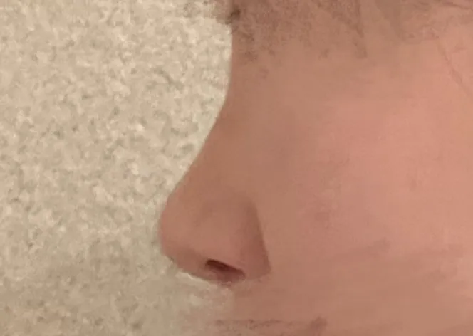 망한거 같은데 코 잘아는 언니 ..?