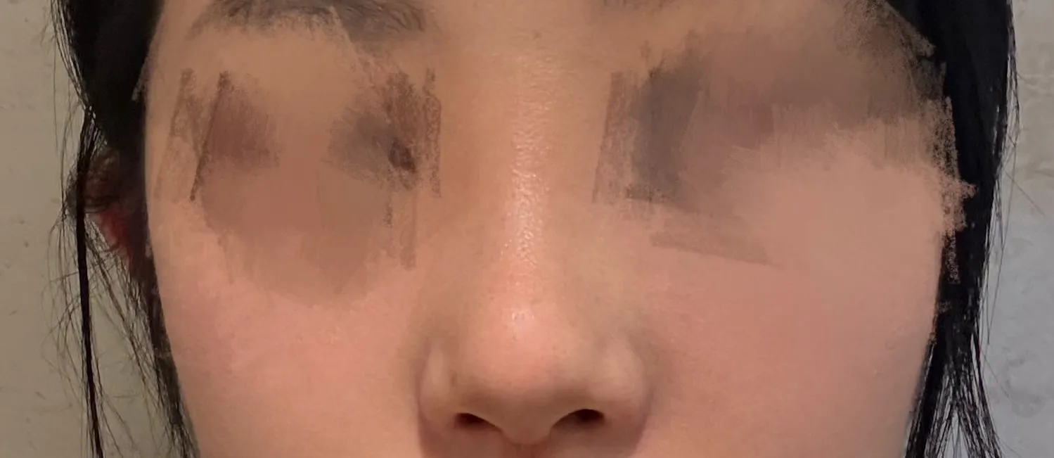 망한거 같은데 코 잘아는 언니 ..?2